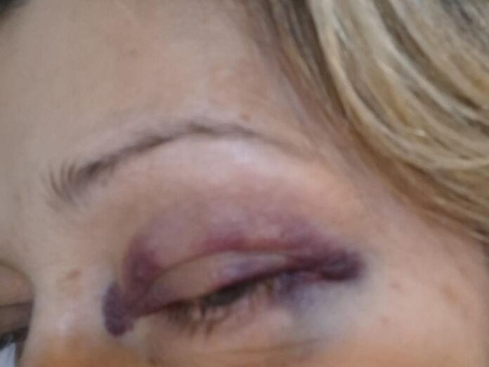 a3c305e6275ac5050c145e458a610f2a xl.jpg