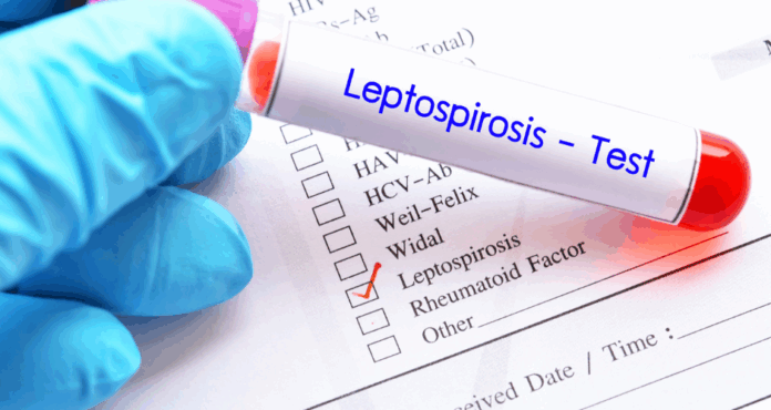 leptospeirwsh ti einai pws kollaei kai pws 8erapeyetai 2xknmy.png