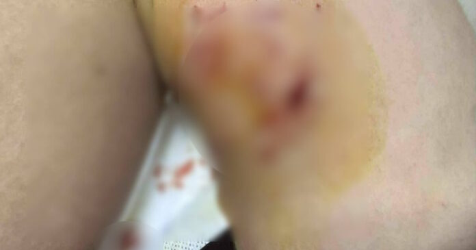 trauma skuli3 1200x630.jpg