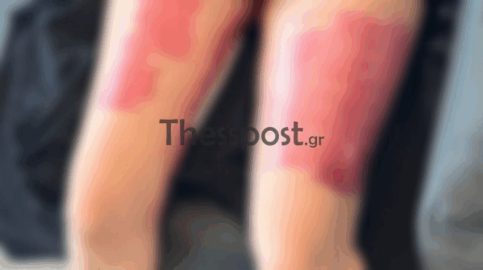 thesss1.png