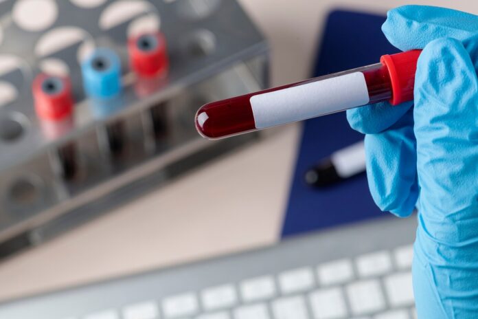 surgeon holding blood test.jpg